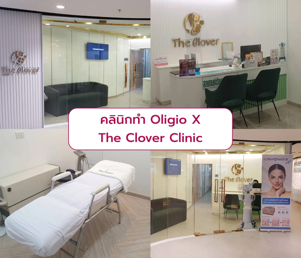 คลินิกทำ Oligio X The Clover Clinic