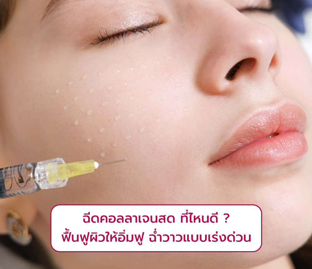 ฉีดคอลลาเจนสด ที่ไหนดี