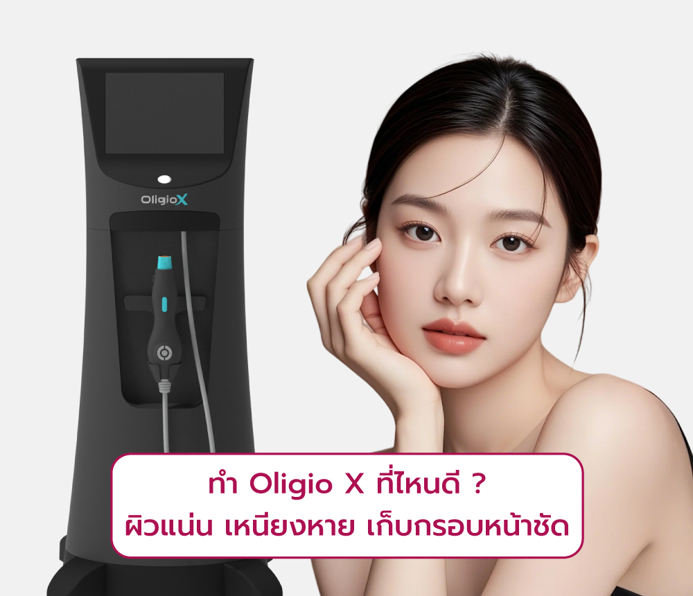 Oligio X ที่ไหนดี