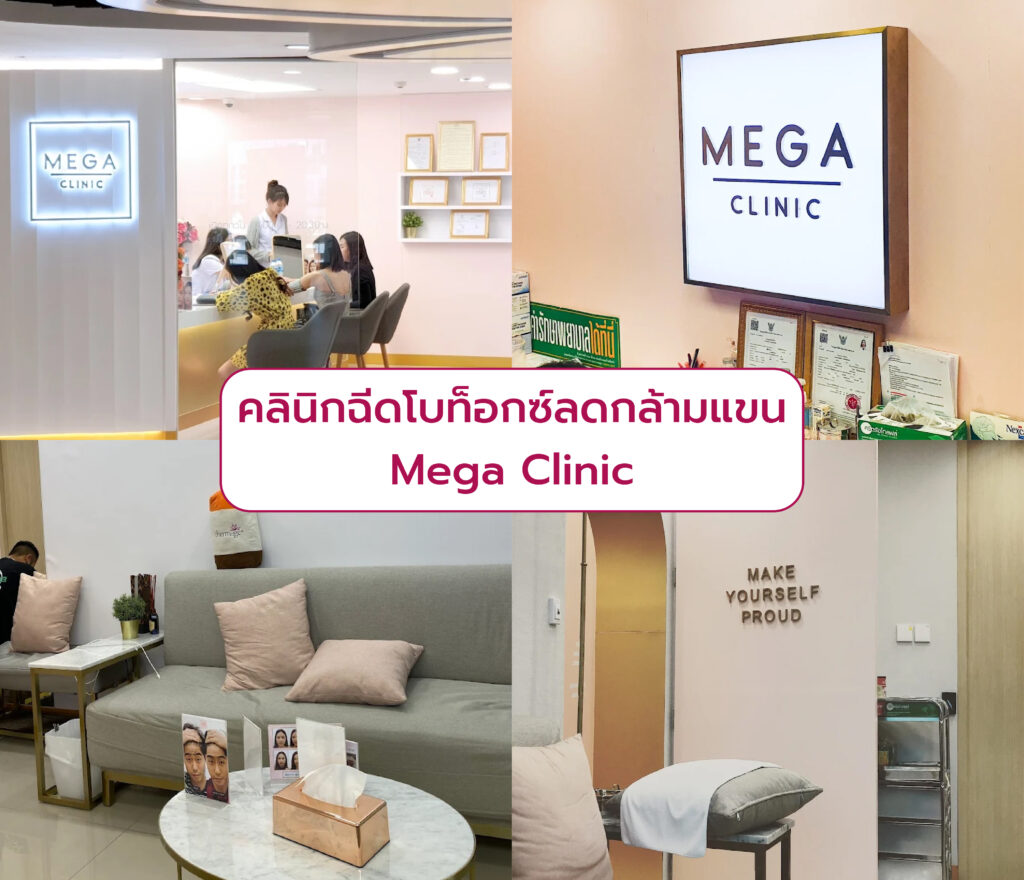 โบท็อกลดกล้ามแขน ฉีดที่ไหนดี Mega Clinic