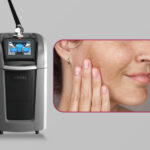 Picosure Pro ที่ไหนดี-370x-277