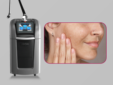 Picosure Pro ที่ไหนดี-370x-277