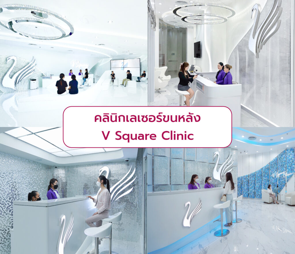 คลินิกเลเซอร์ขนหลัง V Square Clinic