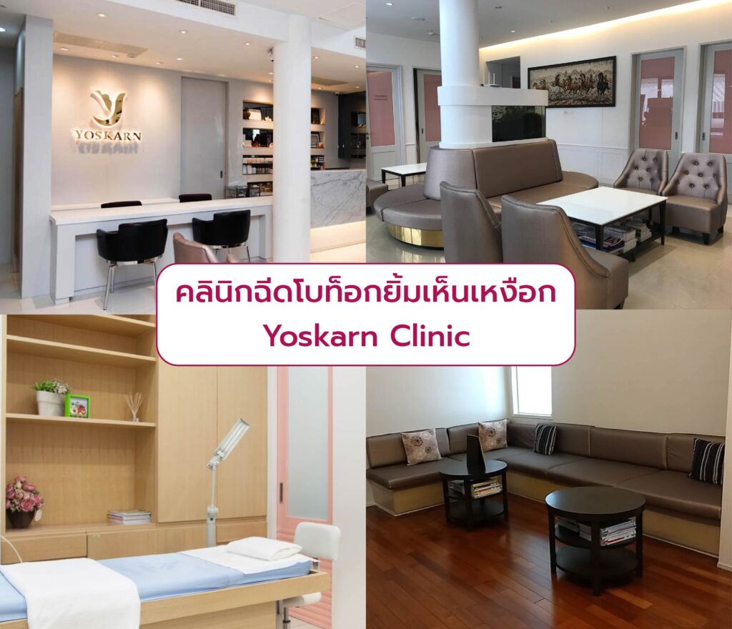ฉีดโบท็อก Gummy Smile Yoskarn Clinic