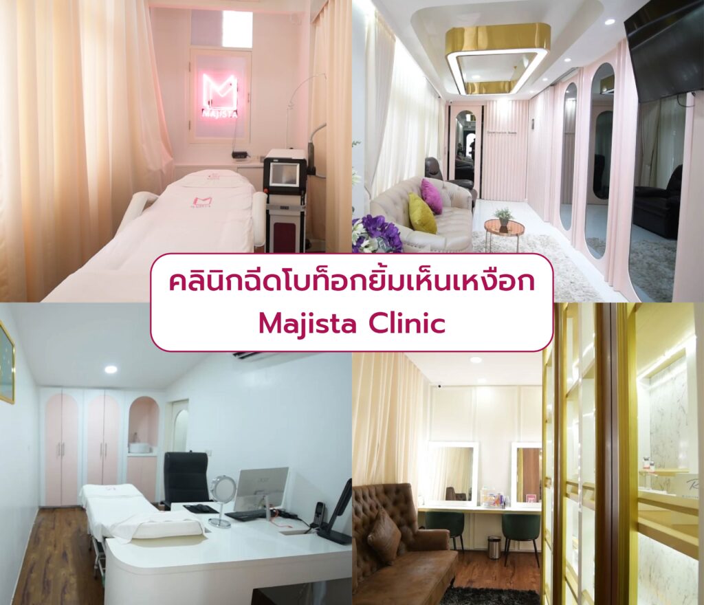 ฉีดโบท็อกยิ้มเห็นเหงือก ที่ไหนดี Majista Clinic