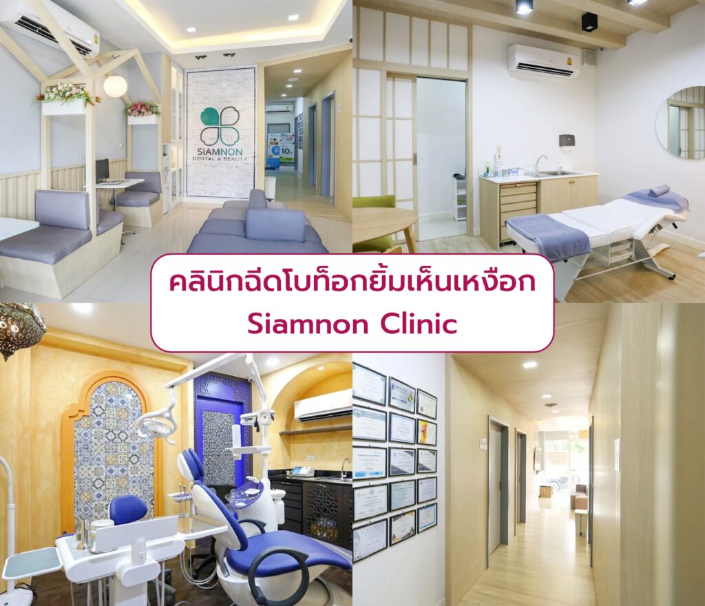 ฉีดโบท็อกแก้ยิ้มเห็นเหงือก ที่ไหนดี Siamnon Clinic