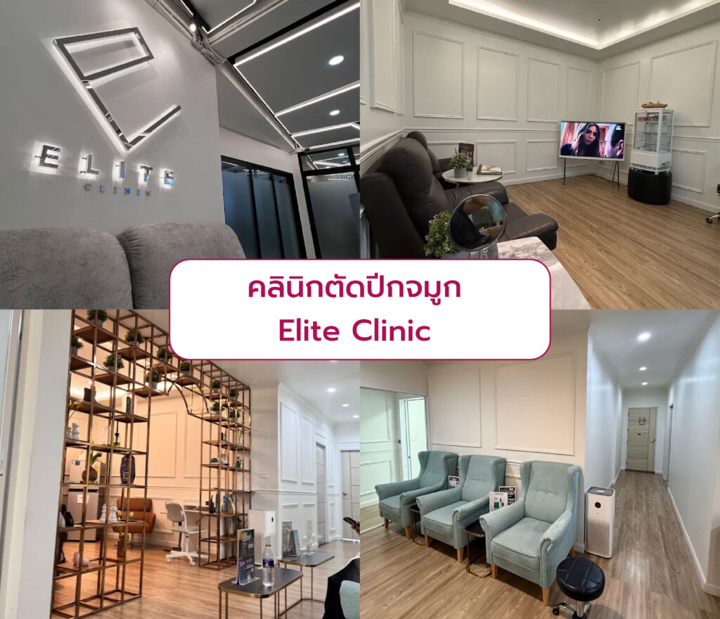 ตัดปีกจมูก ที่ Elite Clinic