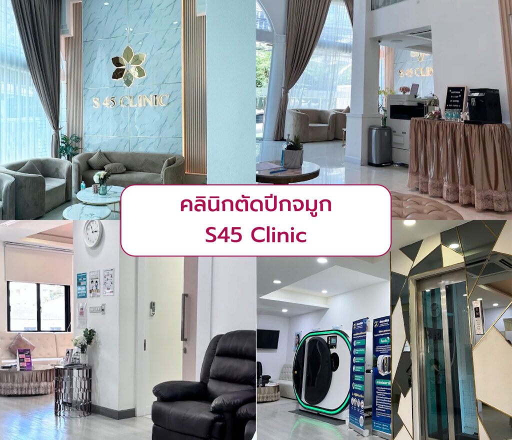 ตัดปีกจมูก ที่ไหนดี S45 Clinic
