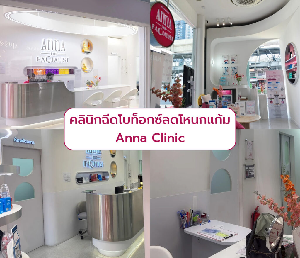เลือกฉีดโบท็อกลดโหนกแก้ม ที่ไหนดี Anna Clinic