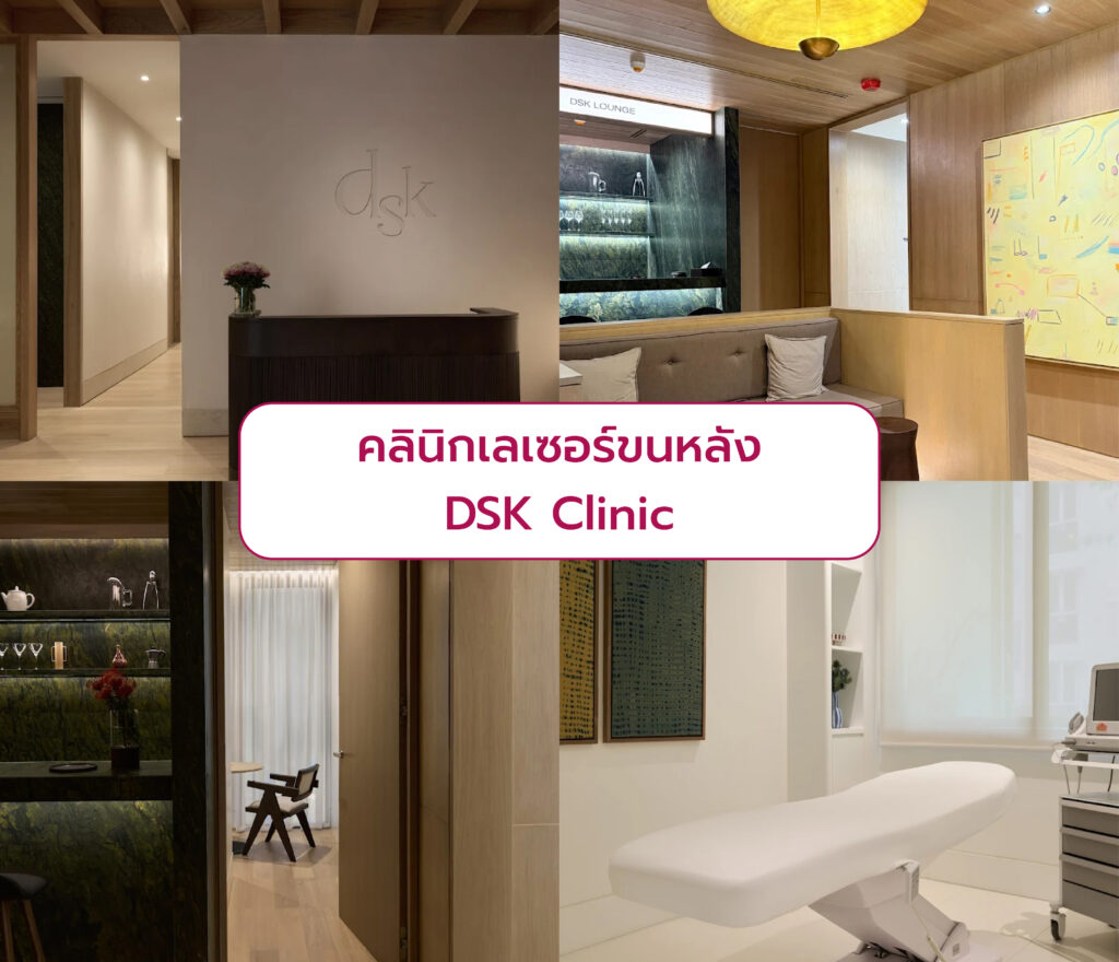เลือกเลเซอร์ขนหลัง ที่ไหนดี DSK Clinic