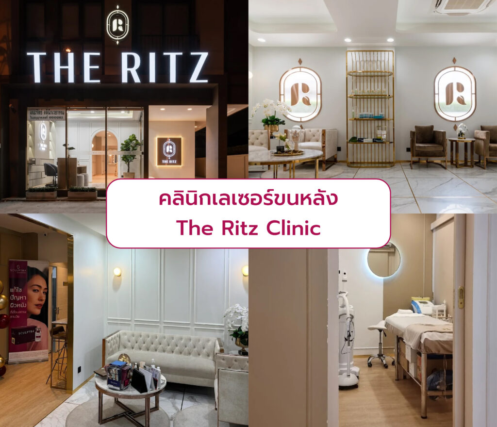 เลือกเลเซอร์ขนหลัง ที่ไหนดี The Ritz Clinic
