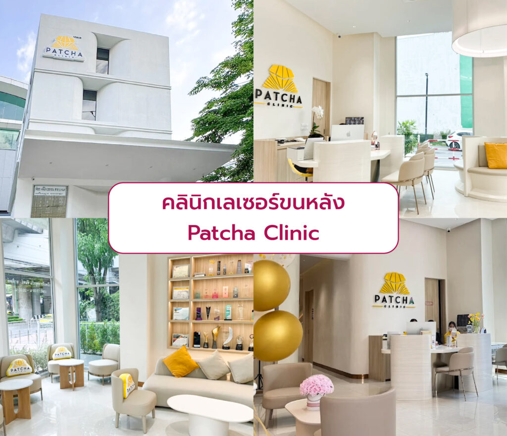 เลเซอร์ขนที่หลัง ที่ไหนดี Patcha Clinic