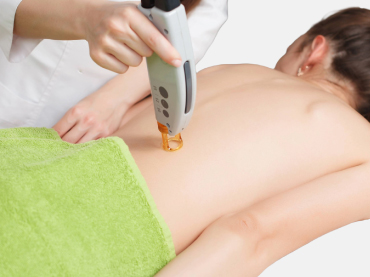 เลเซอร์ขนหลังที่ไหนดี370x277