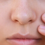 โบท็อกกระชับรูขุมขน ที่ไหนดี