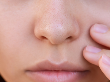 โบท็อกกระชับรูขุมขน ที่ไหนดี