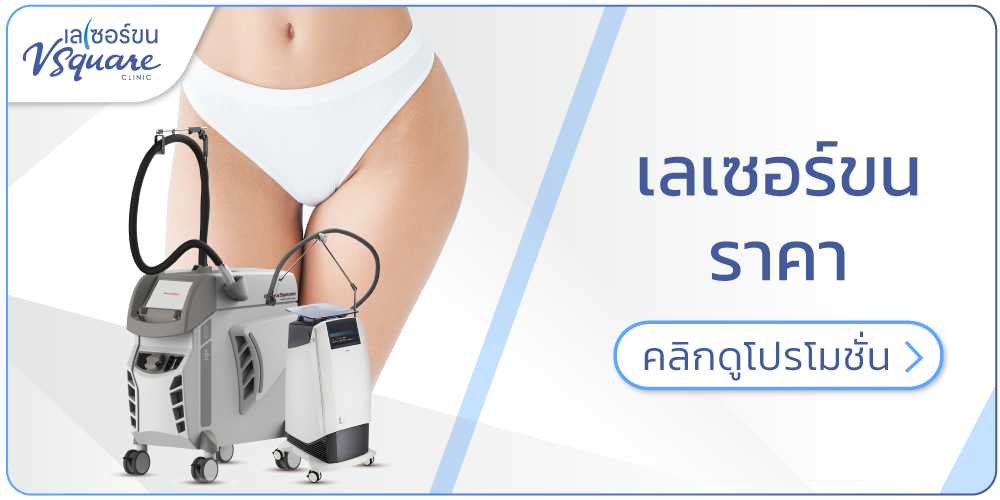 โปรโมชัน เลเซอร์ขน