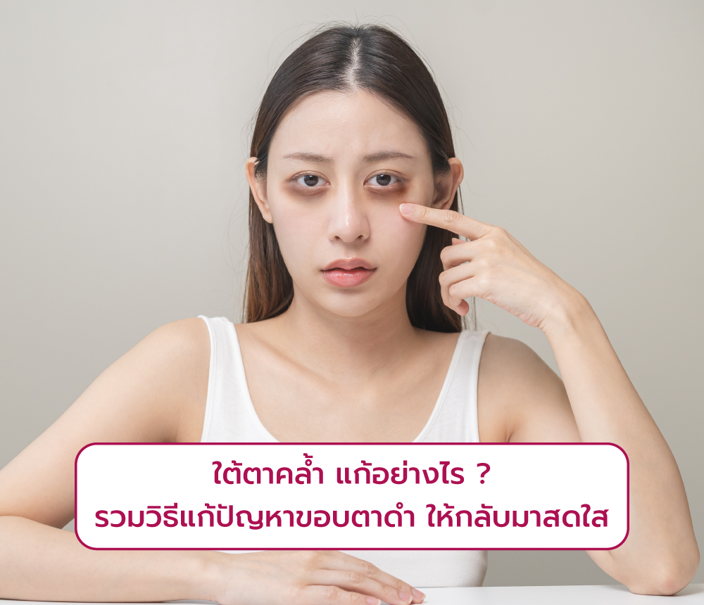 ใต้ตาคล้ำ