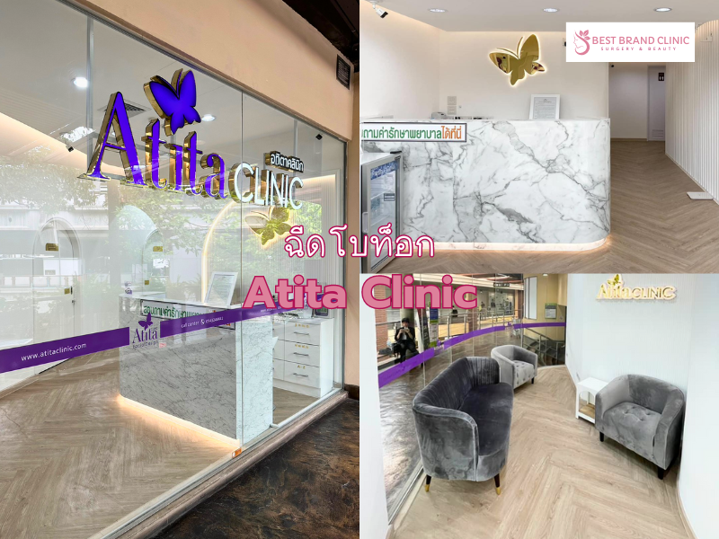 Best Botox Clinic Atita Clinic