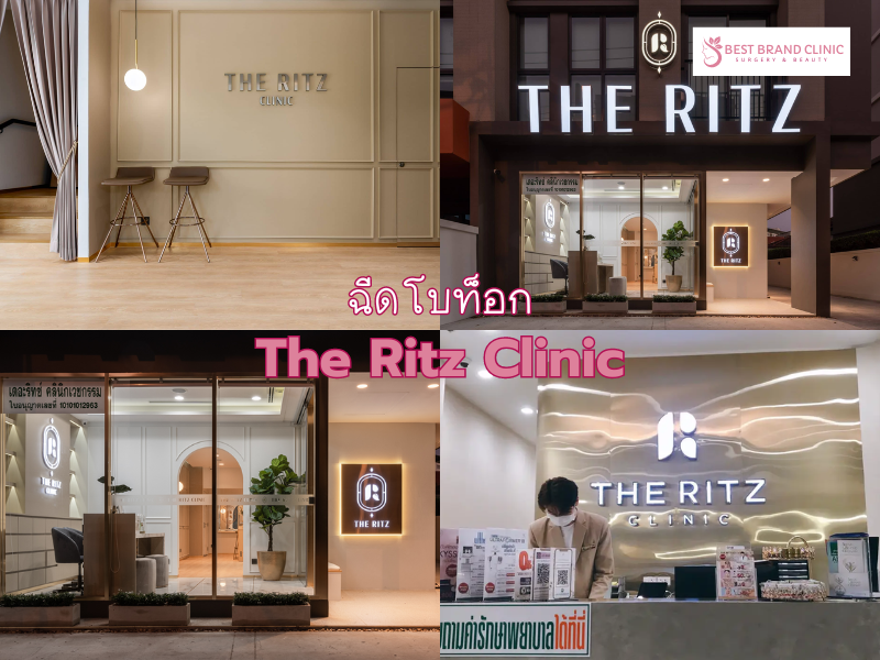 Best Botox Clinic The Ritz Clinic