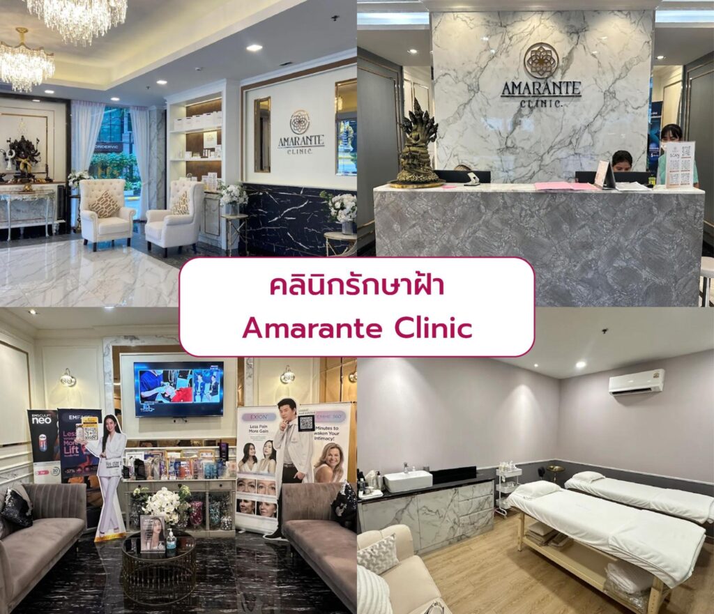 Best clinic for Melasma treatment Amarante Clinic