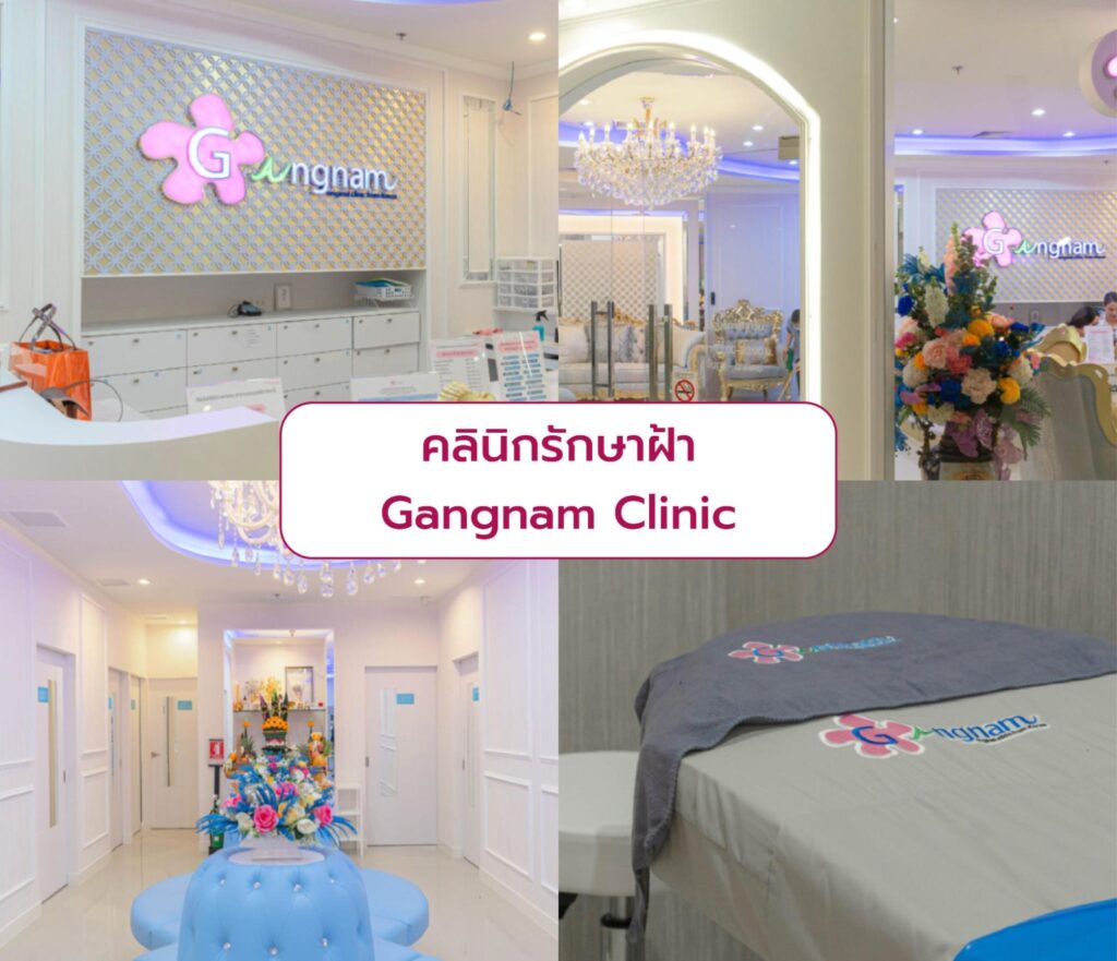 Best clinic for Melasma treatment Gangnam Clinic