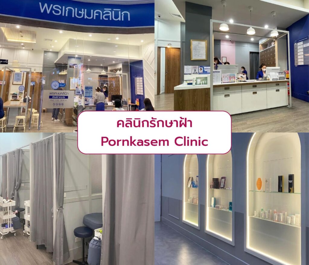 Best clinic for Melasma treatment Pornkasem Clinic