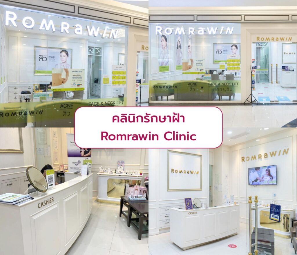 Best clinic for Melasma treatment Romrawin Clinic