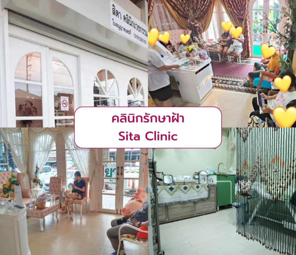 Best clinic for Melasma treatment Sita Clinic
