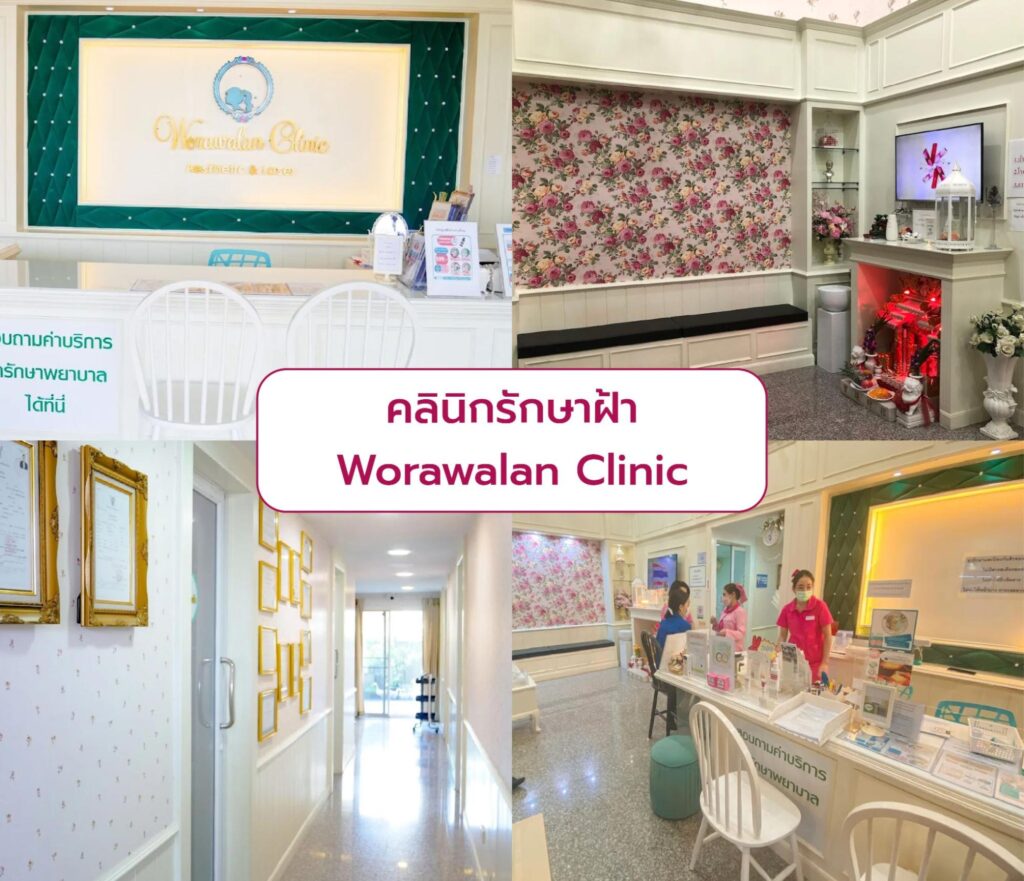 Best clinic for Melasma treatment Worawalan Clinic