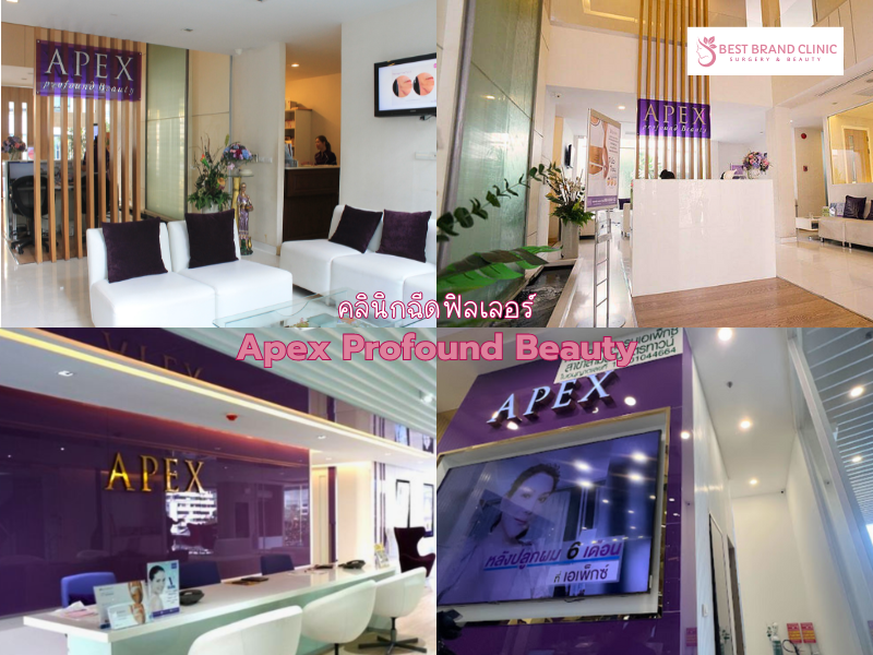 Best filler clinic Apex Profound Beauty