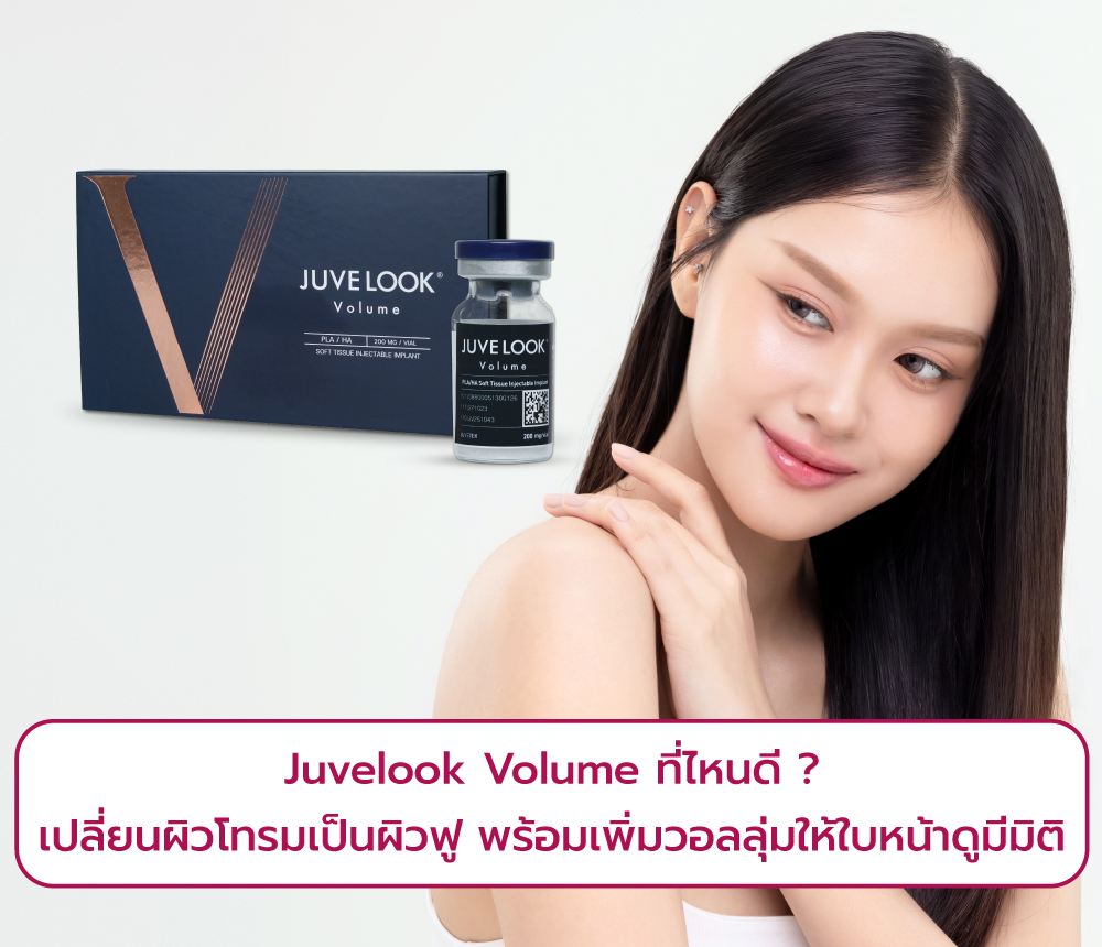  Juvelook Volume ที่ไหนดี