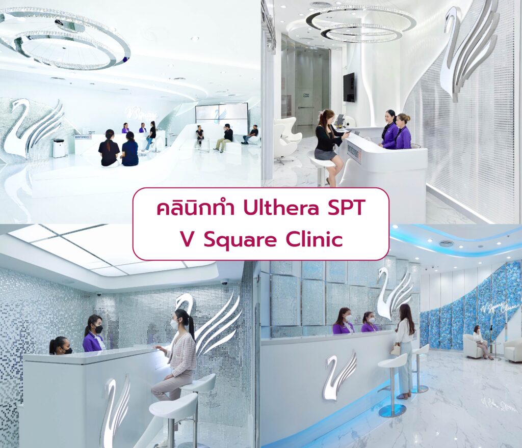 Ulthera SPT ที่ไหนดี V Square Clinic