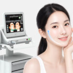 Ulthera-SPT-ที่ไหนดี370x277