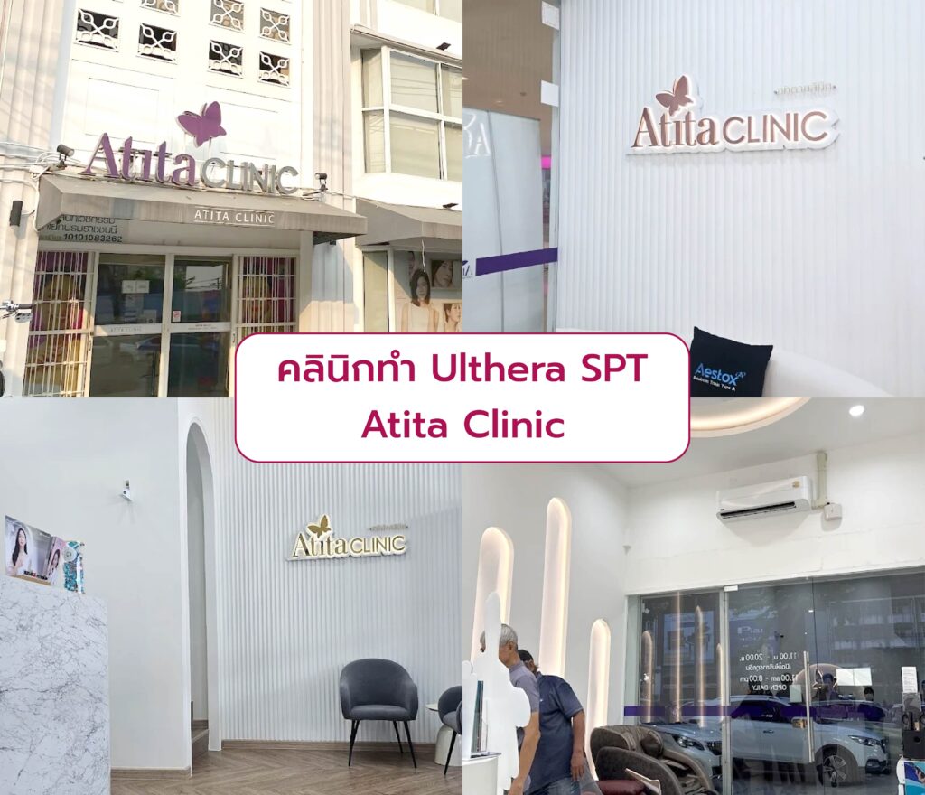 Ulthera SPT ยกกระชับที่ไหนดี Atita Clinic