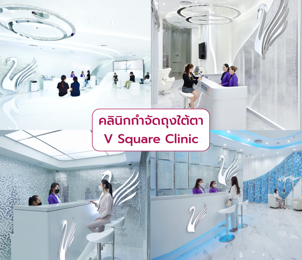 กำจัดถุงใต้ตา ที่ไหนดี V Square Clinic