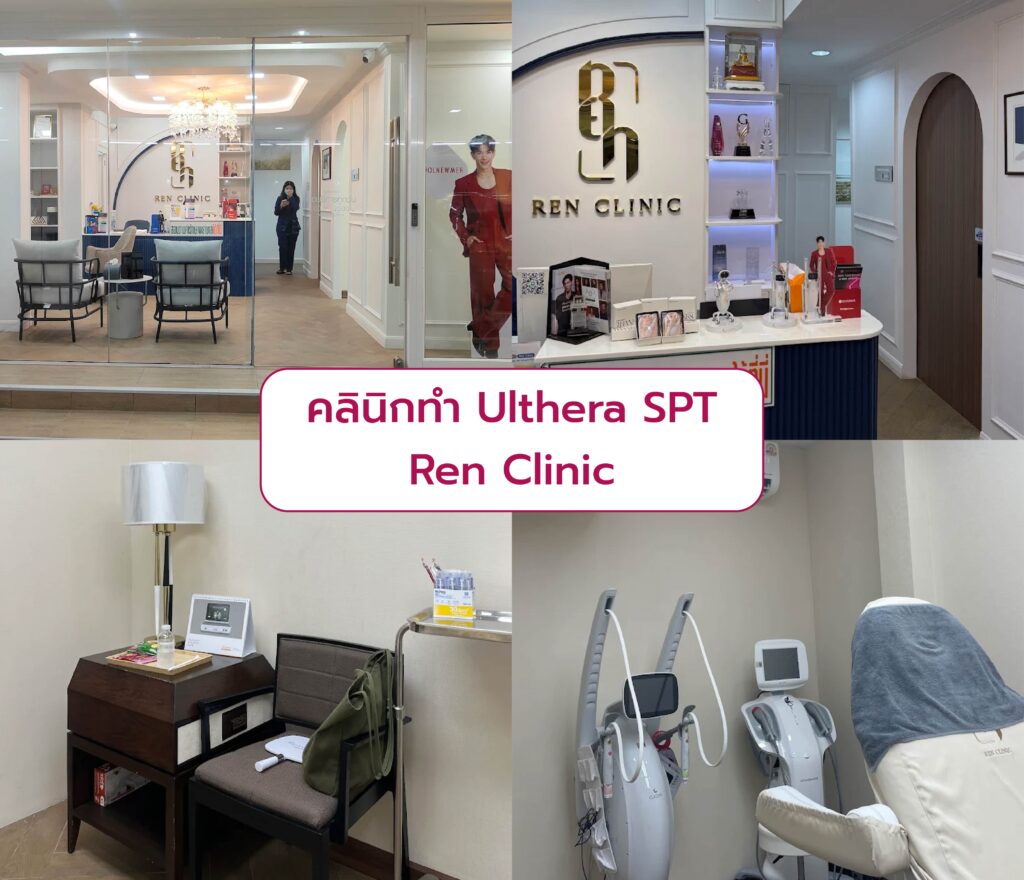 คลินิกทำ Ulthera SPT ที่ไหนดี Ren clinic