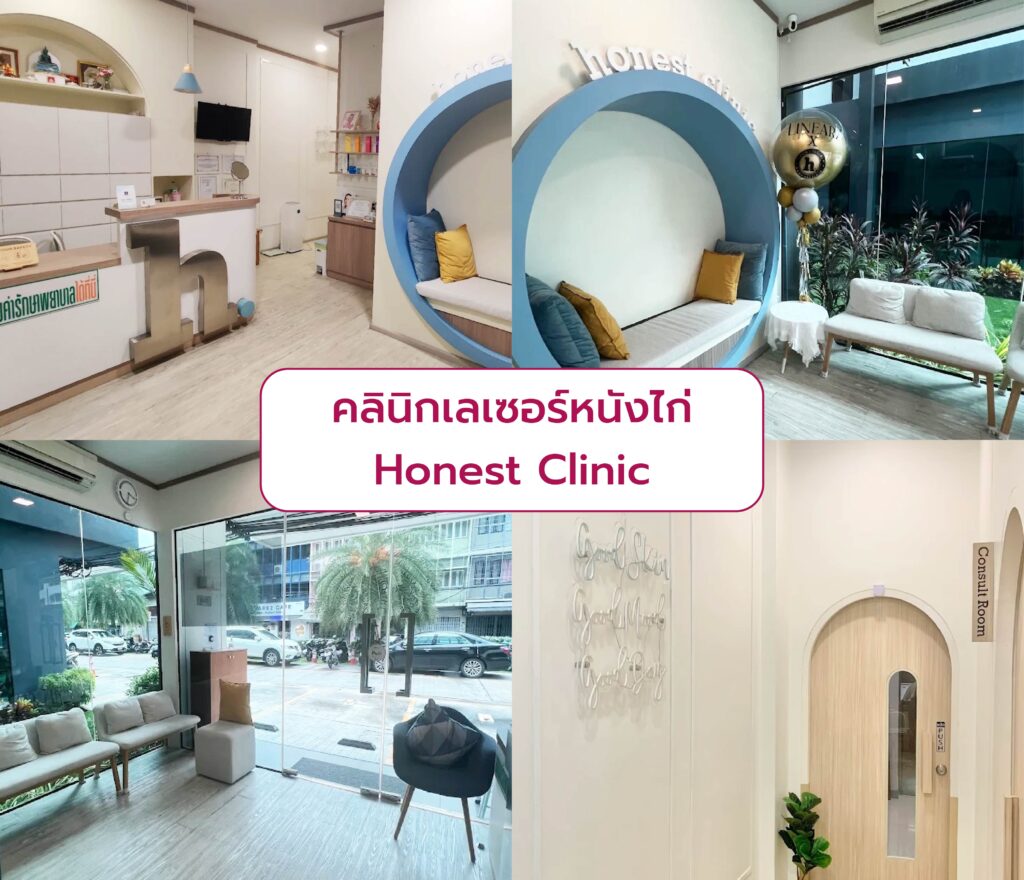 คลินิกเลเซอร์หนังไก่ ที่ไหนดี Honest Clinic