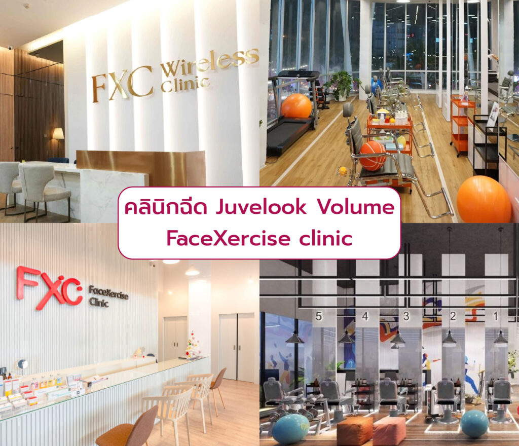ฉีด Juvelook Volume ที่ไหนดี FaceXercise clinic