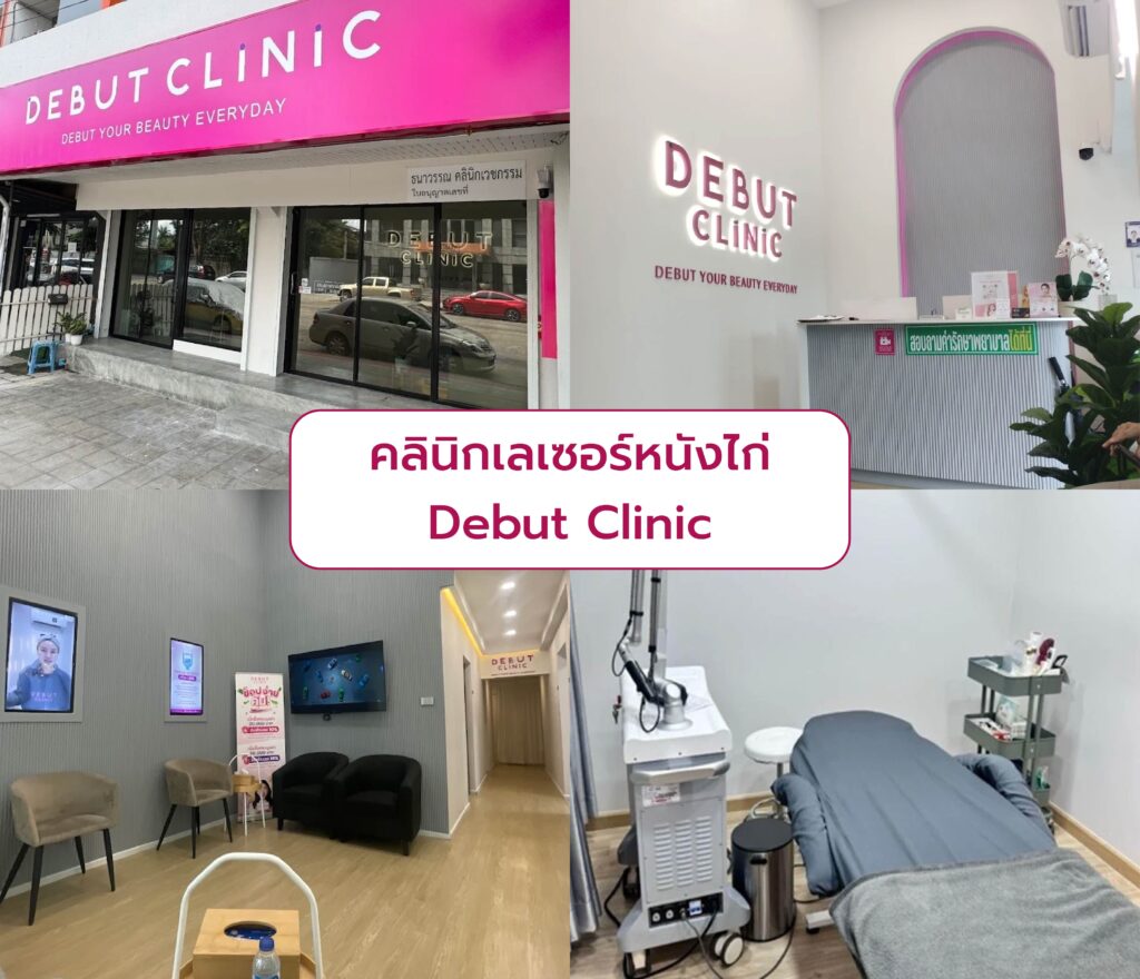 ทำเลเซอร์หนังไก่ ที่ไหนดี Debut Clinic