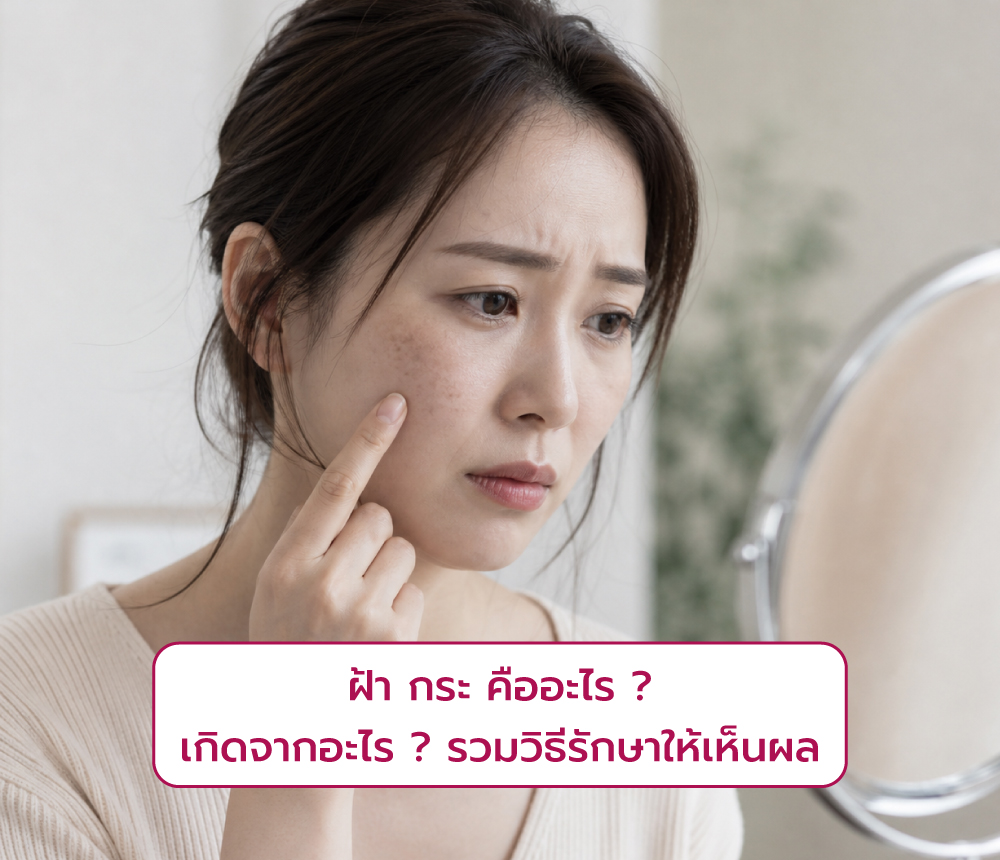 ฝ้า กระ