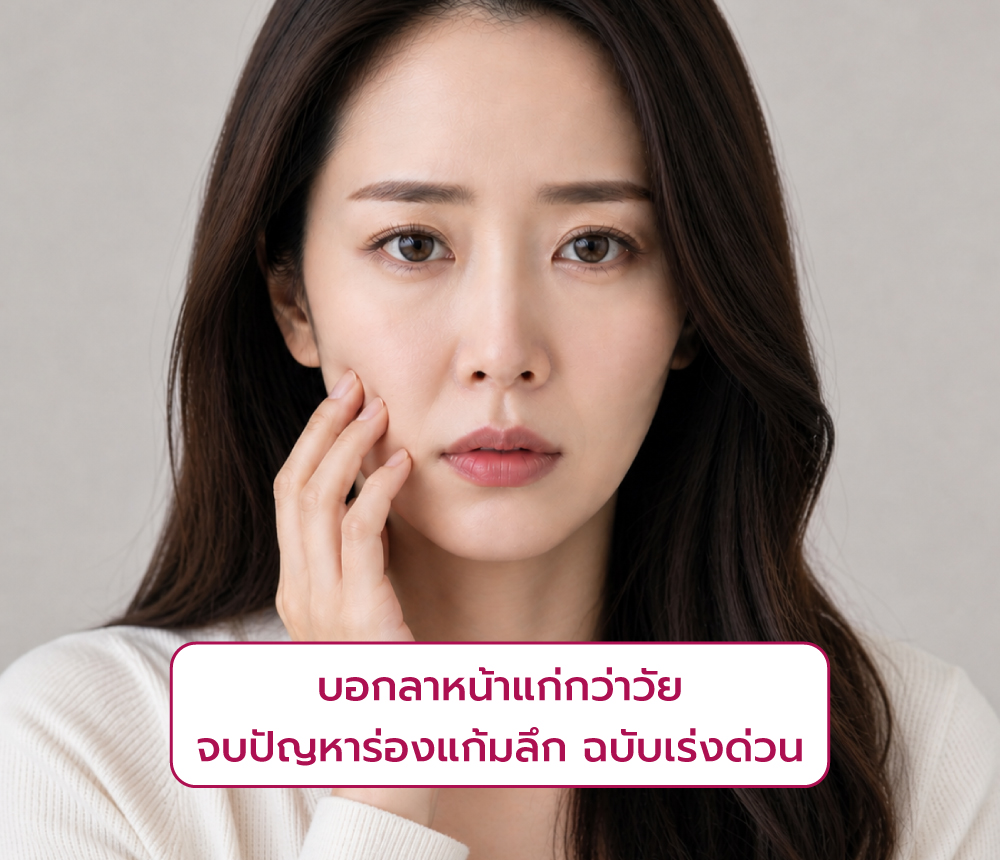 ร่องแก้มลึก