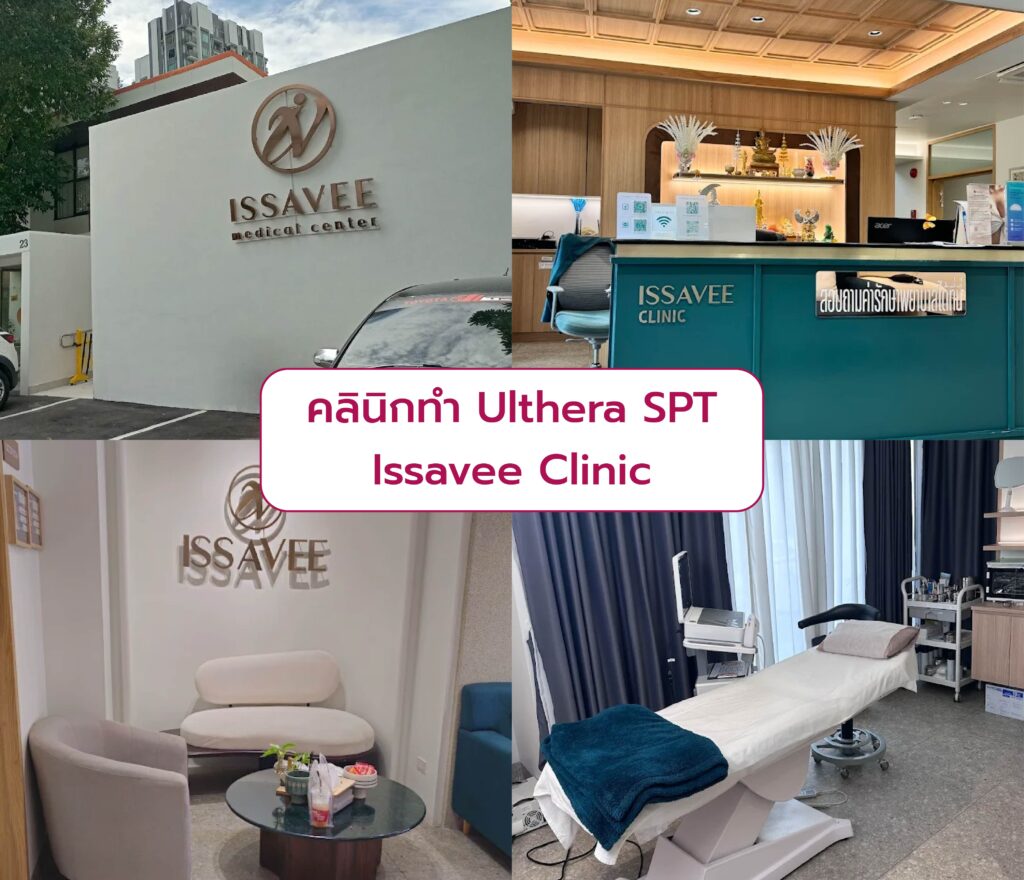 เลือกคลินิก Ulthera SPT ที่ไหนดี Issavee Clinic