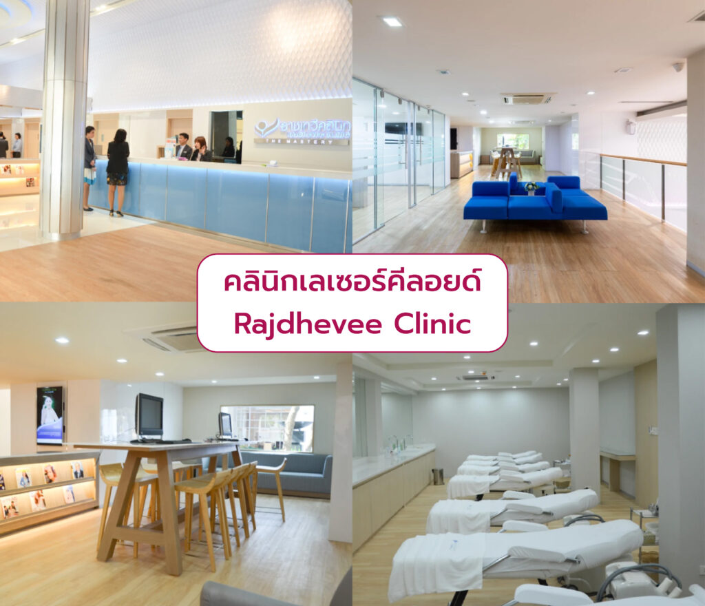 เลเซอร์รักษาคีลอยด์ ที่ไหนดี Rajdhevee Clinic
