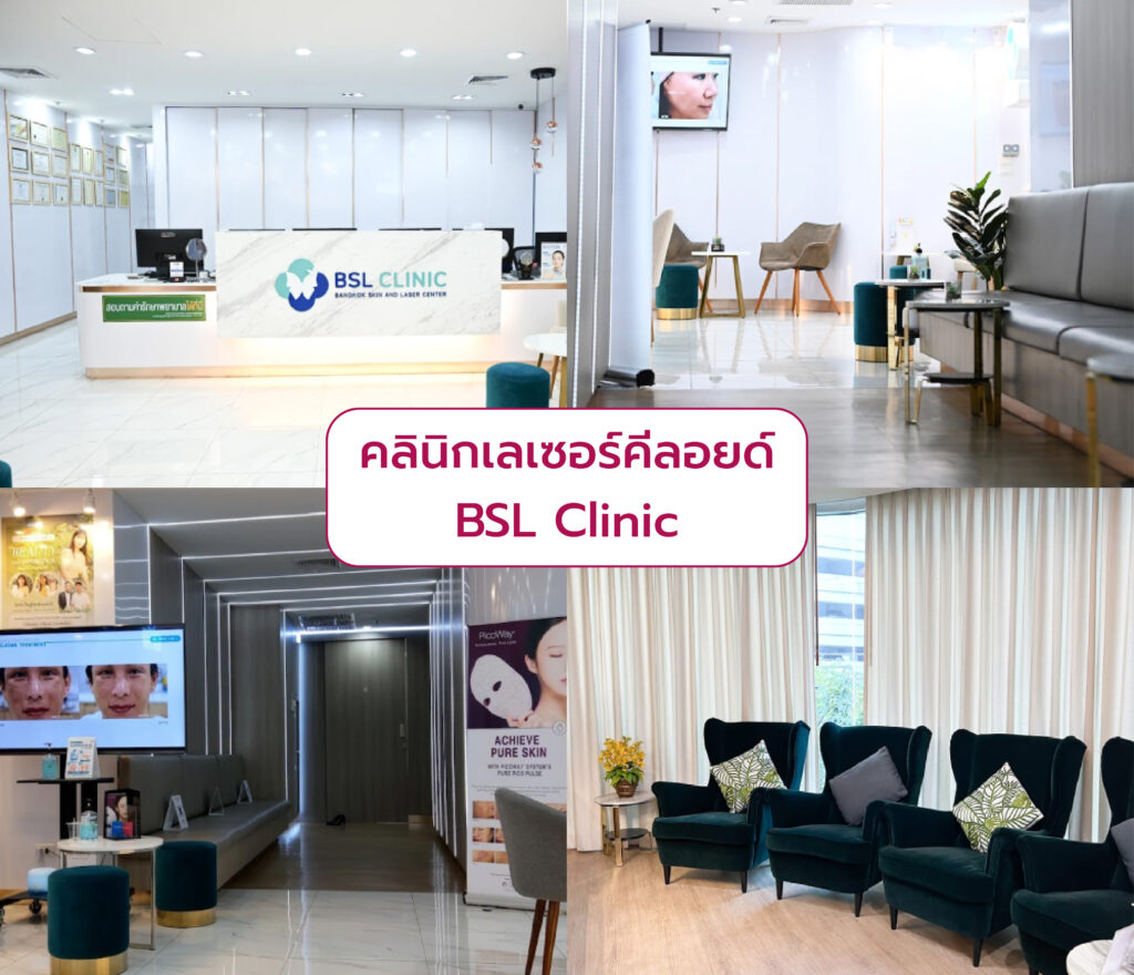 เลเซอร์รักษาแผลเป็นคีลอยด์ ที่ไหนดี BSL Clinic