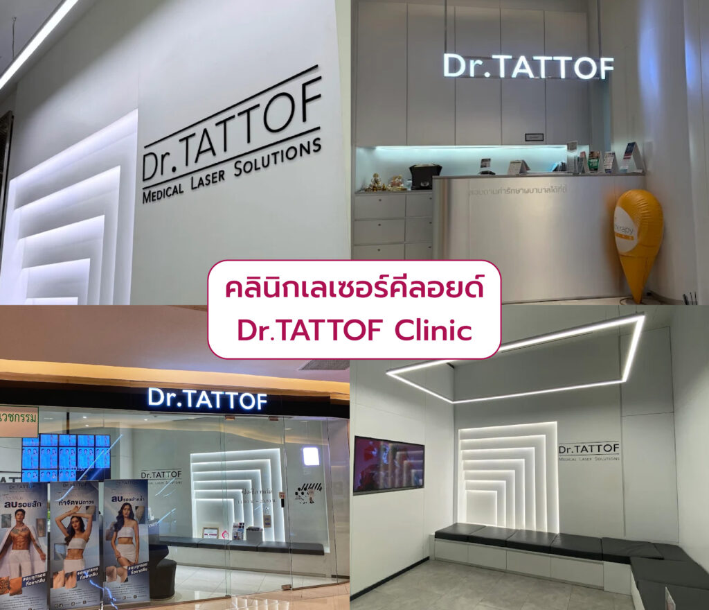 เลเซอร์ลบคีลอยด์ ที่ไหนดี Dr.TATTOF Clinic