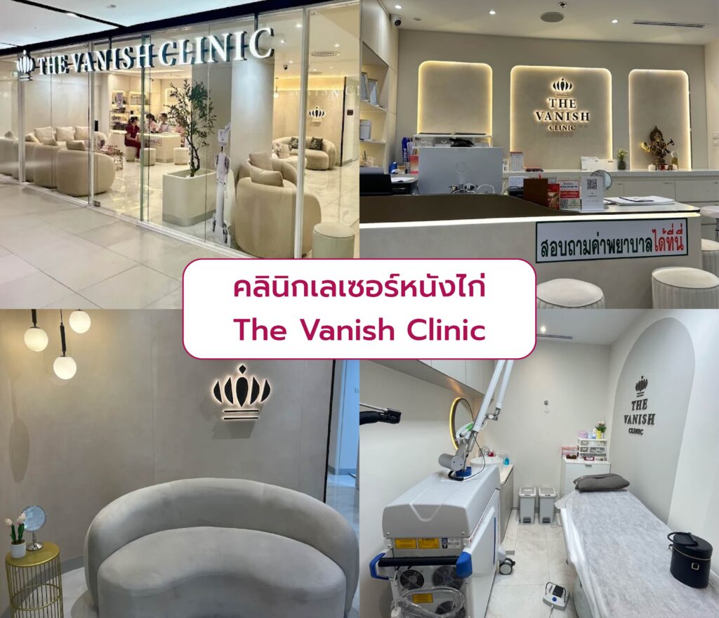 เลเซอร์หนังไก่ คลินิกไหนดี The Vanish Clinic