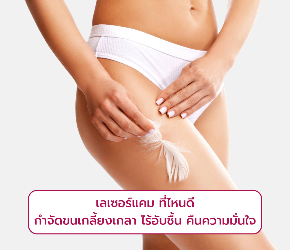เลเซอร์แคมที่ไหนดี
