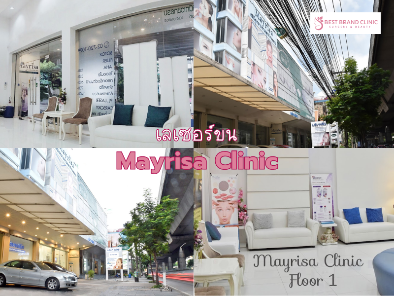 Best laser hair removal clinic Mayrisa Clinic
