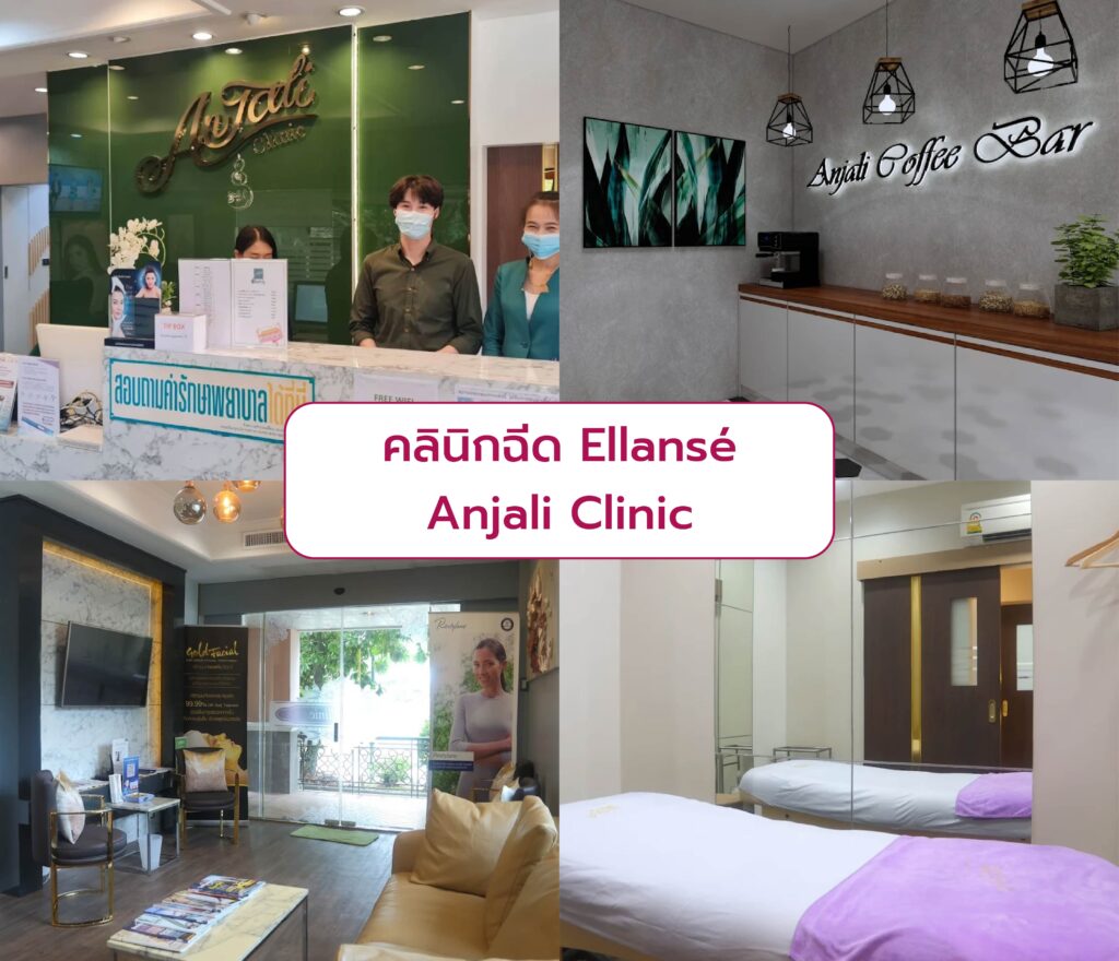 คลินิกฉีด Ellanse Anjali Clinic