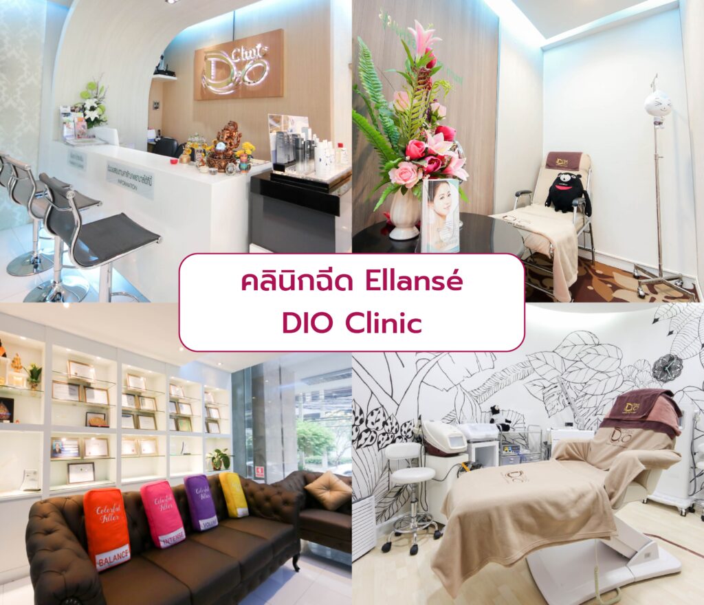 คลินิกฉีด Ellanse DIO Clinic